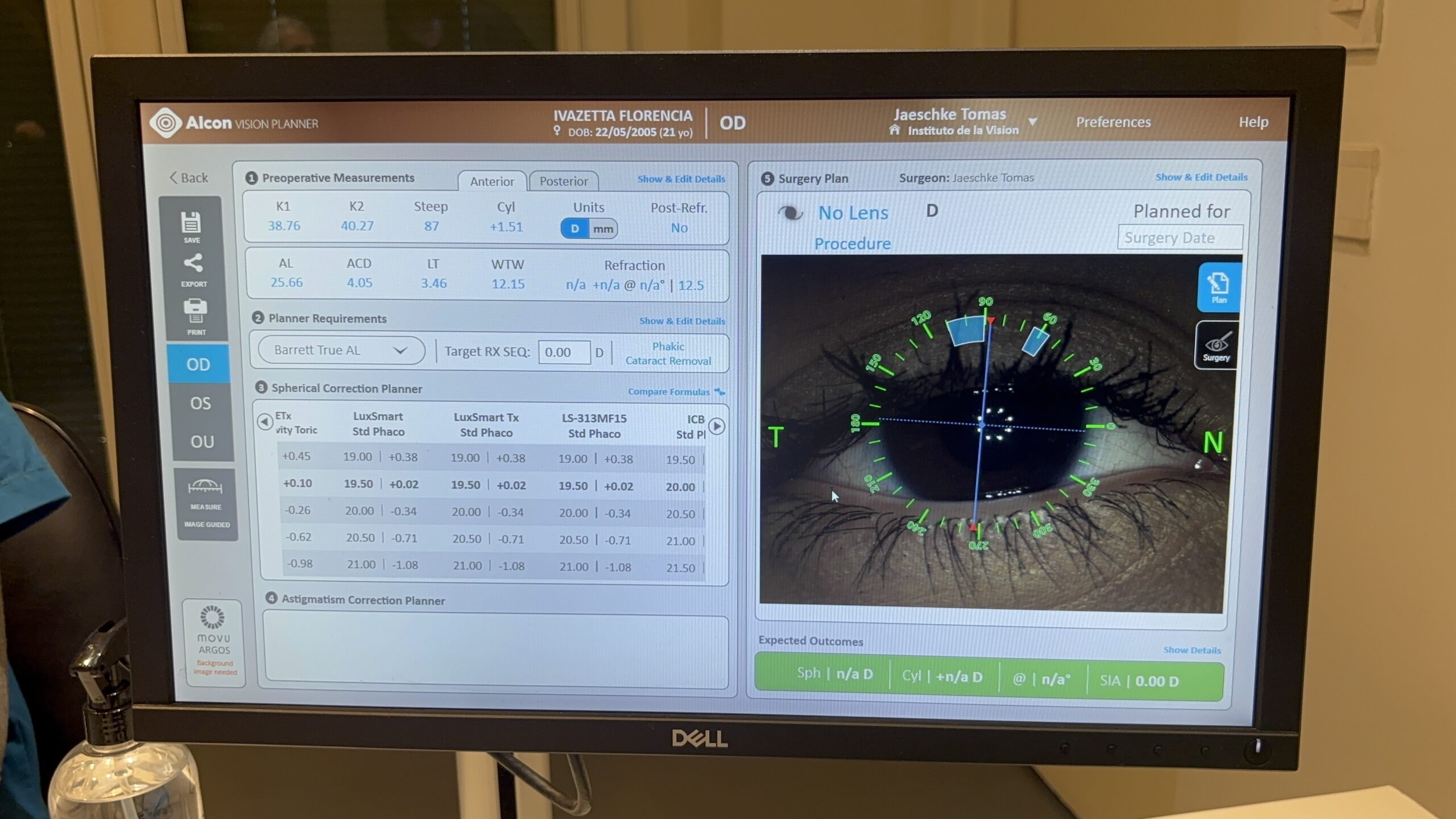 Equipamiento